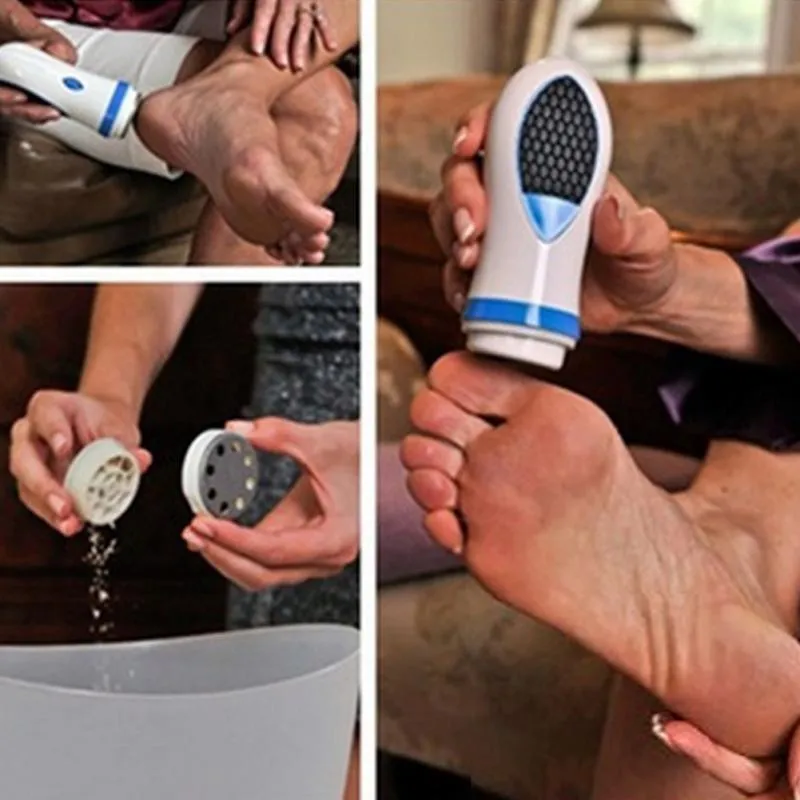 Callus Remover